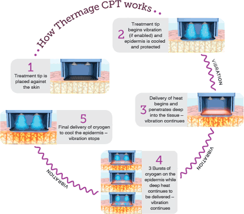 فناوری CPT برای لیفت و جوانسازی پوست