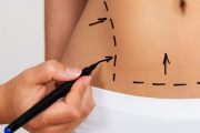 آیا تکنیک های غیر تهاجمی درمان چاقی های موضعی را می شناسید؟