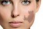 جوانسازی پوست با هایفوتراپی (HIFU) صورت