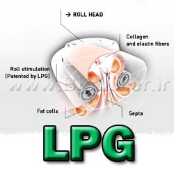 LPG treatment