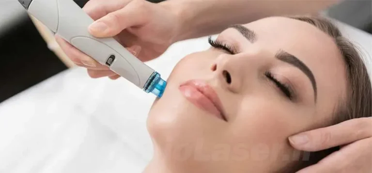 microderm abrasion