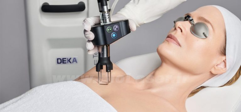 CO2fractional-laser-biolaser.ir