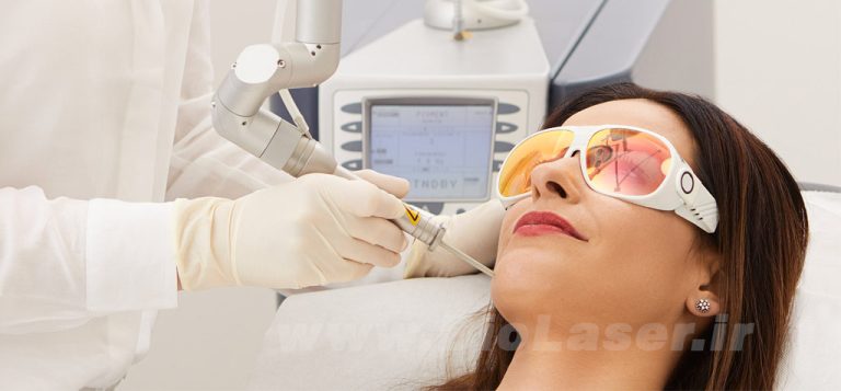 CO2laser-rejuvenation
