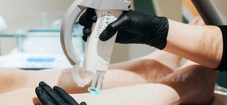 Nd-yag-laser-biolaser.ir